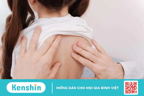 Teo cơ delta: Cẩn thận dị dạng xương ở trẻ nhỏ và giảm vận động ở người lớn