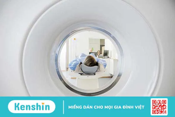 Teo cơ delta: Cẩn thận dị dạng xương ở trẻ nhỏ và giảm vận động ở người lớn