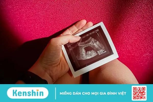 Thai nhi 10 tuần tuổi phát triển thế nào? Dấu hiệu thai 10 tuần khỏe mạnh