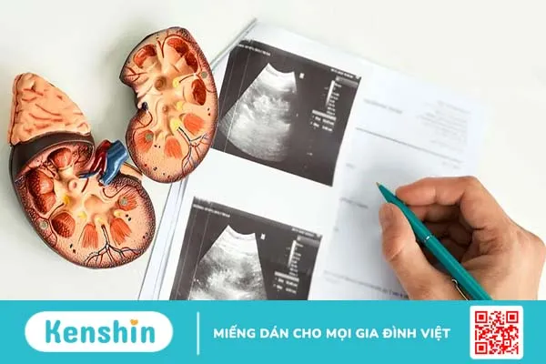 Thận ứ nước cấp độ 2 và những điều bạn cần biết