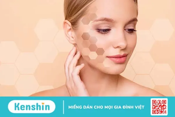 Thay da sinh học – phương pháp điều trị cho vết thương rộng