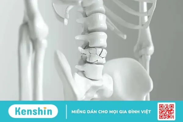 Thiếu vitamin K gây bệnh gì? Có nguy hiểm không?