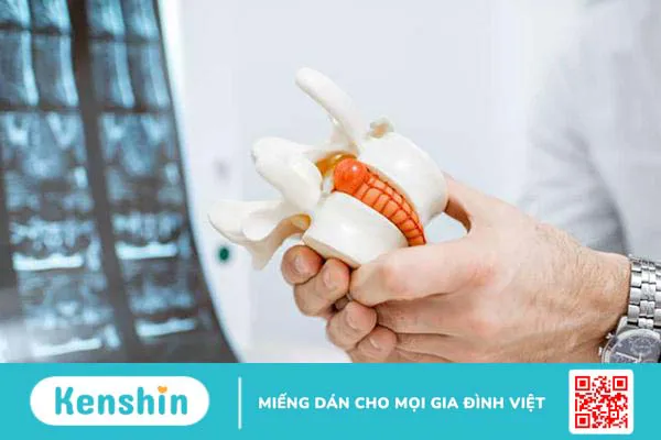 Thoát vị đĩa đệm có chữa được không? Chữa bằng cách nào?