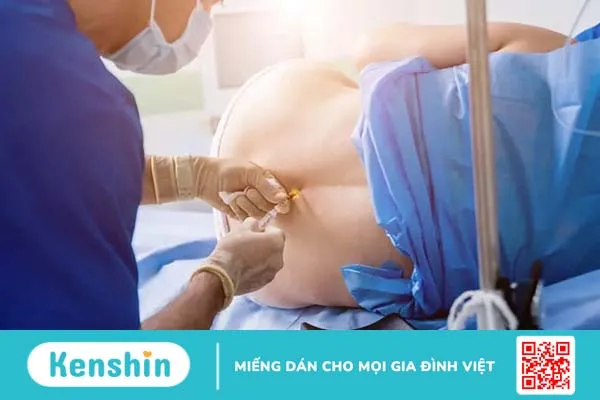 Thông tin về gây tê và những lưu ý cho bệnh nhân