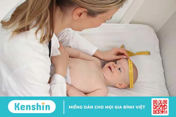 Thóp của trẻ sơ sinh đóng sớm hay trễ có đáng lo không?