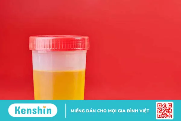 Thử thai bằng đường chính xác không? Hướng dẫn chi tiết cách thực hiện