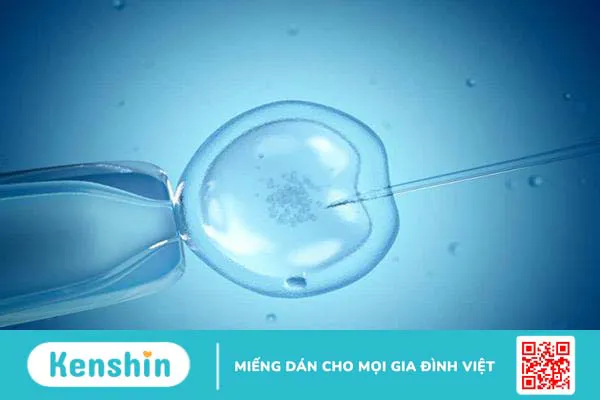 Thụ tinh trong ống nghiệm: Bạn cần biết điều gì?