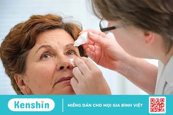 Thuốc nhỏ mắt trị cườm nước: Tác dụng, phân loại và cách dùng