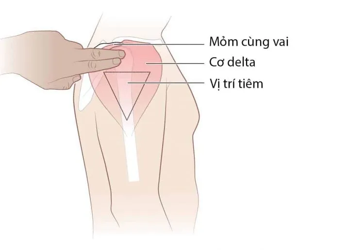 Tiêm bắp: Vị trí, quy trình và những lưu ý khi tiêm