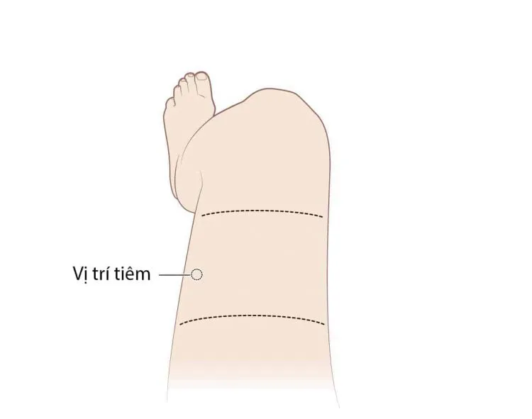 Tiêm bắp: Vị trí, quy trình và những lưu ý khi tiêm