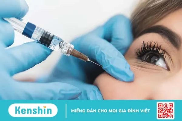 Tiêm filler có an toàn không? Các tác dụng phụ bạn cần biết khi tiêm filler