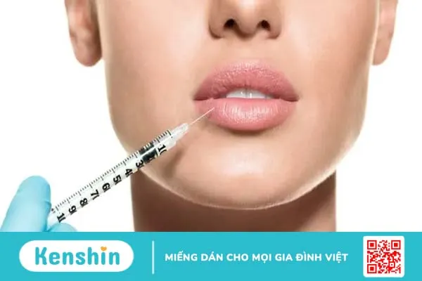 Tiêm filler môi sẽ kéo dài được bao lâu?