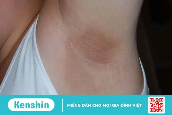 Tiền tiểu đường: Nhận biết sớm để đẩy lùi bệnh!