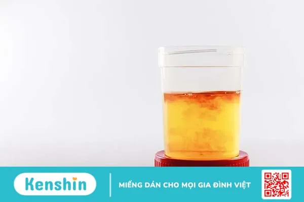 Tiểu buốt tiểu rắt ra máu ở nữ do đâu? Biến chứng và cách điều trị là gì?