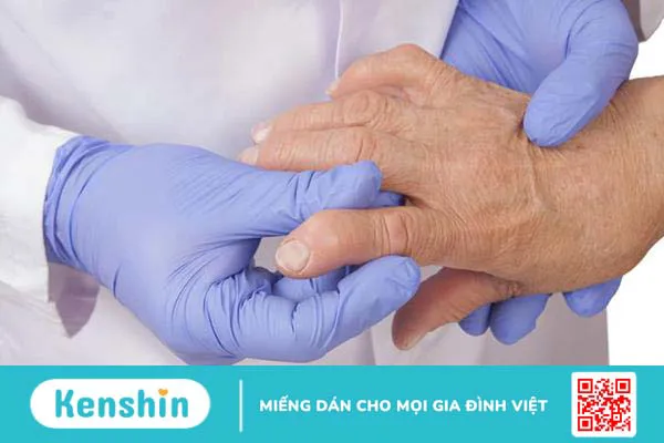 Tiêu chuẩn chẩn đoán viêm khớp dạng thấp và các xét nghiệm cần thiết