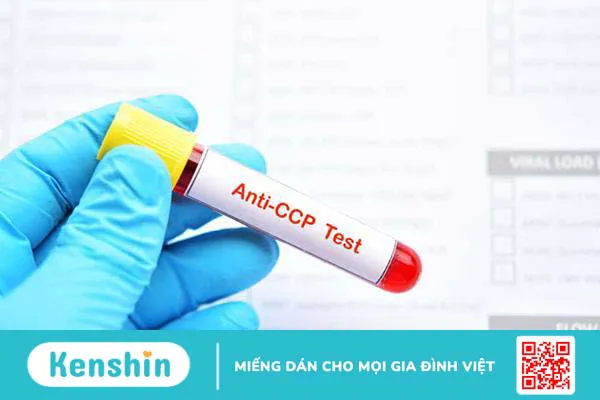 Tiêu chuẩn chẩn đoán viêm khớp dạng thấp và các xét nghiệm cần thiết