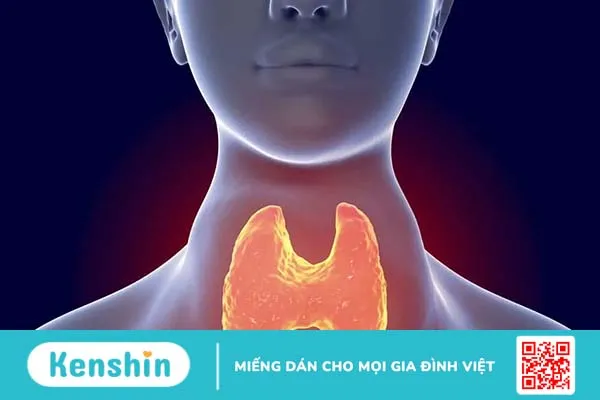 Tìm hiểu 3 phương pháp chữa cường giáp bằng Đông y