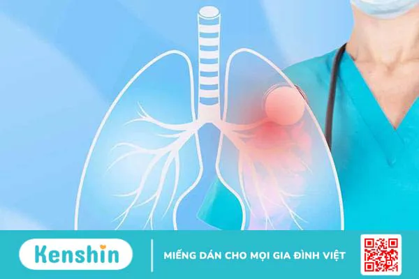 Tìm hiểu về các giai đoạn của lao phổi