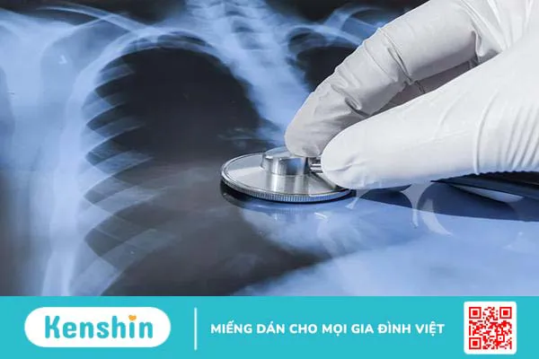 Tìm hiểu về các giai đoạn của lao phổi