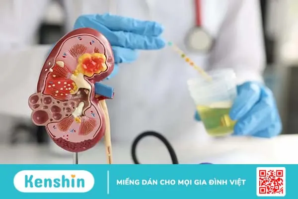 Tìm hiểu về các xét nghiệm ung thư thận