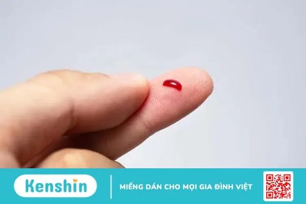 Tìm hiểu về những cách chữa trị bệnh giảm tiểu cầu