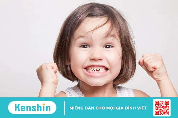 Tìm hiểu về răng mọc lẫy ở trẻ em: Nguyên nhân và cách xử lý