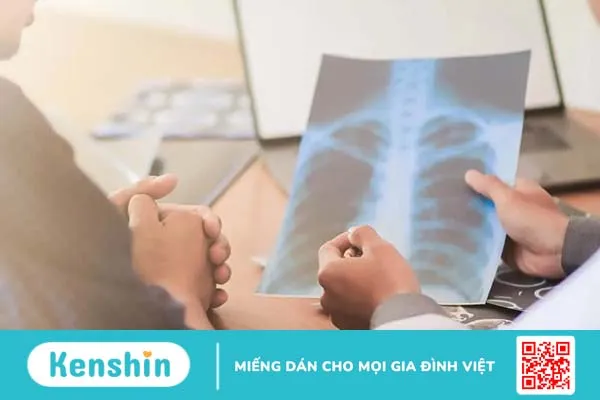 Tìm hiểu về ung thư phổi giai đoạn đầu