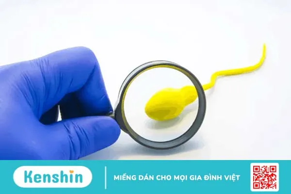 Tinh dịch màu vàng có sao không?