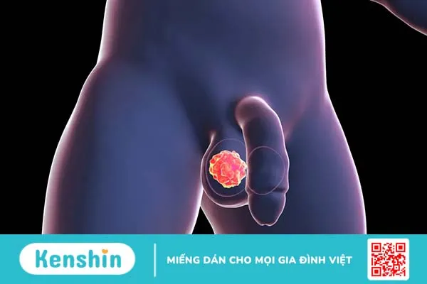 Tinh hoàn nhỏ có ảnh hưởng gì không? Nguyên nhân là gì?