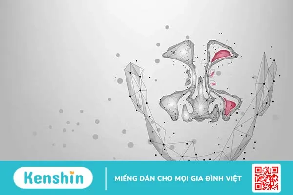 Tổng quan về các loại viêm xoang thường gặp và cách phân biệt