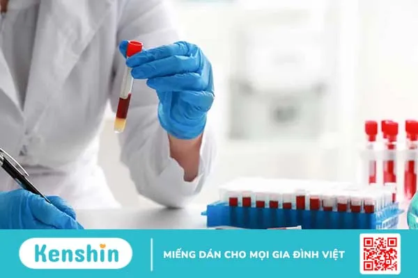 Tổng quan về các loại xét nghiệm ung thư