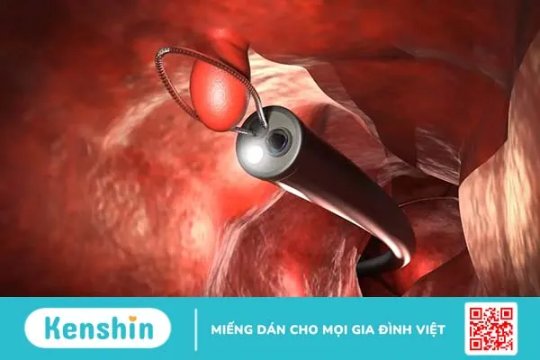 Tổng quan về các loại xét nghiệm ung thư Tổng quan về các loại xét nghiệm ung thư