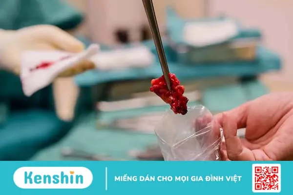 Tổng quan về các loại xét nghiệm ung thư