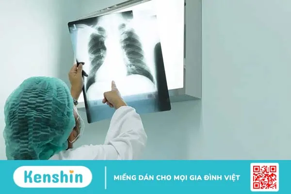 Tổng quan về các phương pháp điều trị ung thư phổi