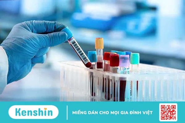 Tổng quan về nhiễm khuẩn hậu sản mà các chị em không nên bỏ qua