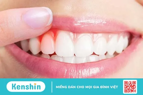 Tổng quan về sức khỏe răng miệng và những thông tin cần biết!