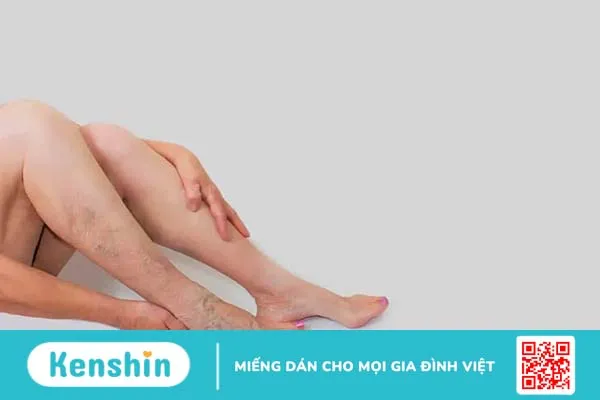 Top 4 gối chống giãn tĩnh mạch được ưa chuộng