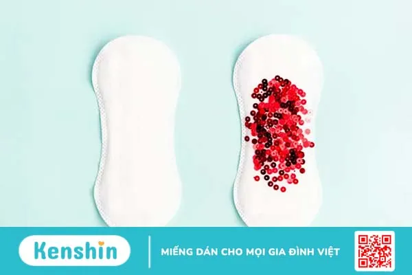 Top 6 dấu hiệu bệnh phụ khoa dễ nhận biết, chị em không nên bỏ qua