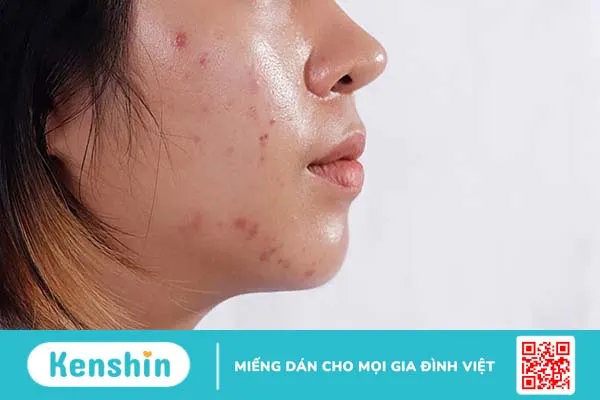 Top 8 sữa rửa mặt cho da hỗn hợp thiên dầu, giúp lấy sạch bụi bẩn mà không làm khô da