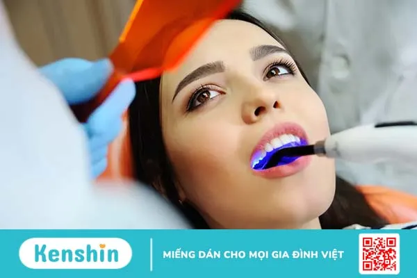 Trám răng thưa để bền và đẹp: Những điều bạn nên biết!