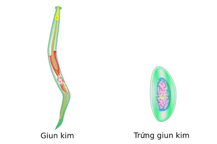 Trẻ bị ngứa hậu môn: Nguyên nhân và cách điều trị hiệu quả