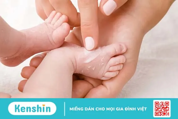 Trẻ bị phát ban nhưng không sốt là bệnh gì? 7 cách xử lý mẹ cần biết