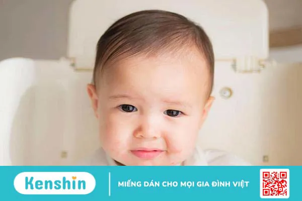 Trẻ bị tay chân miệng bao lâu thì khỏi? Mẹo giúp bé mau khỏi bệnh