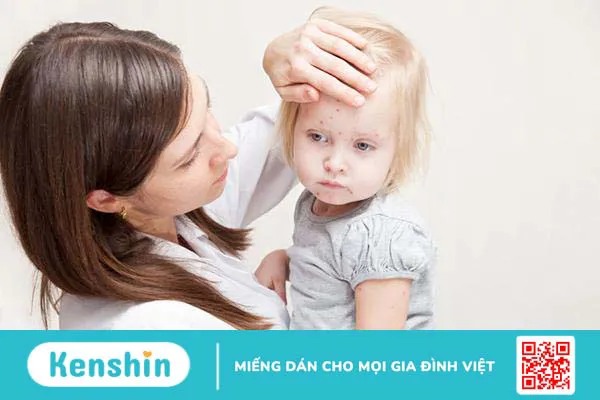 Trẻ sốt phát ban có được tắm không? Cách tắm khoa học để bé mau khỏi