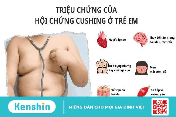 Trẻ thừa cân, béo phì hay đang mắc hội chứng Cushing ở trẻ em?