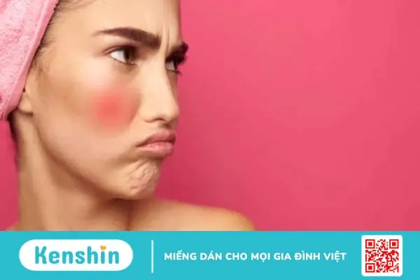 Trị mụn trứng cá bằng kem đánh răng: Lợi hay hại?