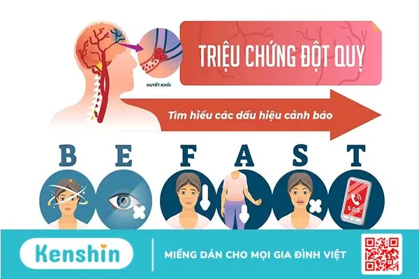 Triệu chứng tai biến mạch máu não nhẹ: Đừng chủ quan xem thường!