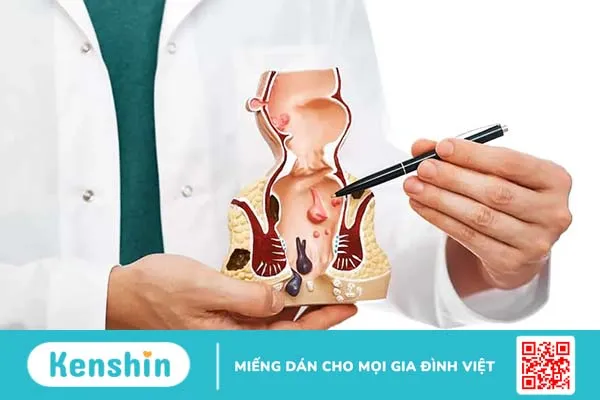 Triệu chứng ung thư trực tràng giai đoạn đầu bạn nên biết