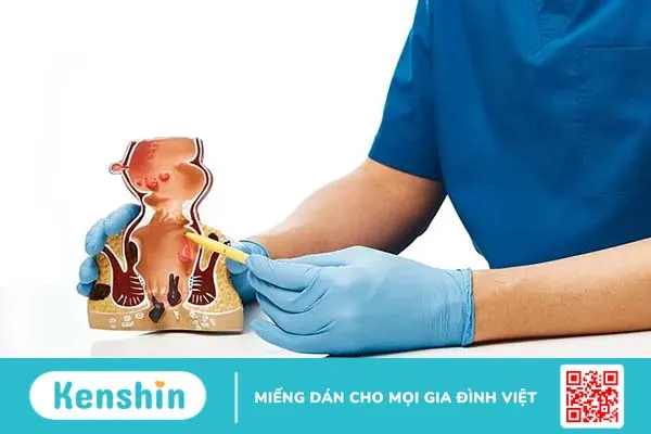 Triệu chứng ung thư trực tràng giai đoạn đầu bạn nên biết