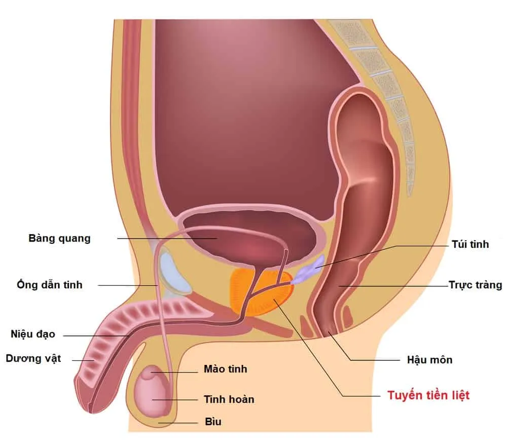 Triệu chứng ung thư tuyến tiền liệt có thể bạn chưa biết